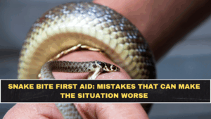 Snake Bite First Aid: Mistakes That Can Make the Situation Worse